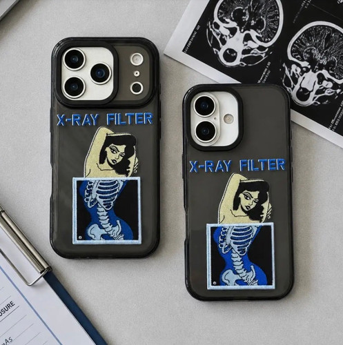 قاب گوشی آیفون آنتی شوک X-Ray